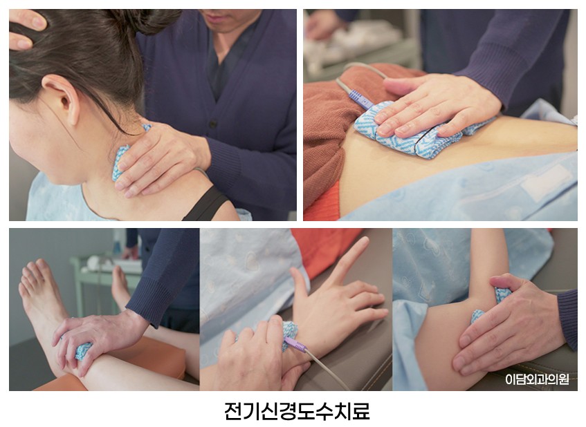 전기신경도수치료.jpg