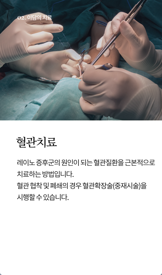 혈관치료