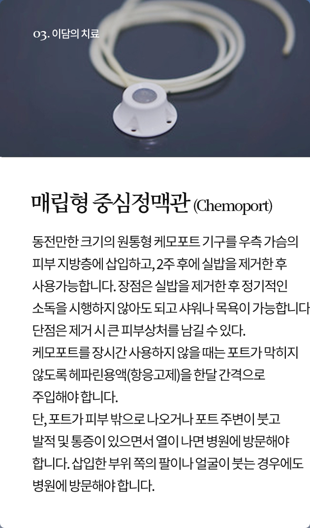 매립형 중심정맥관 (Chemoport)