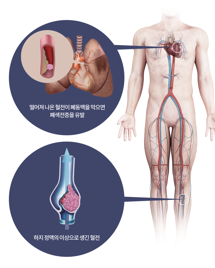 원인