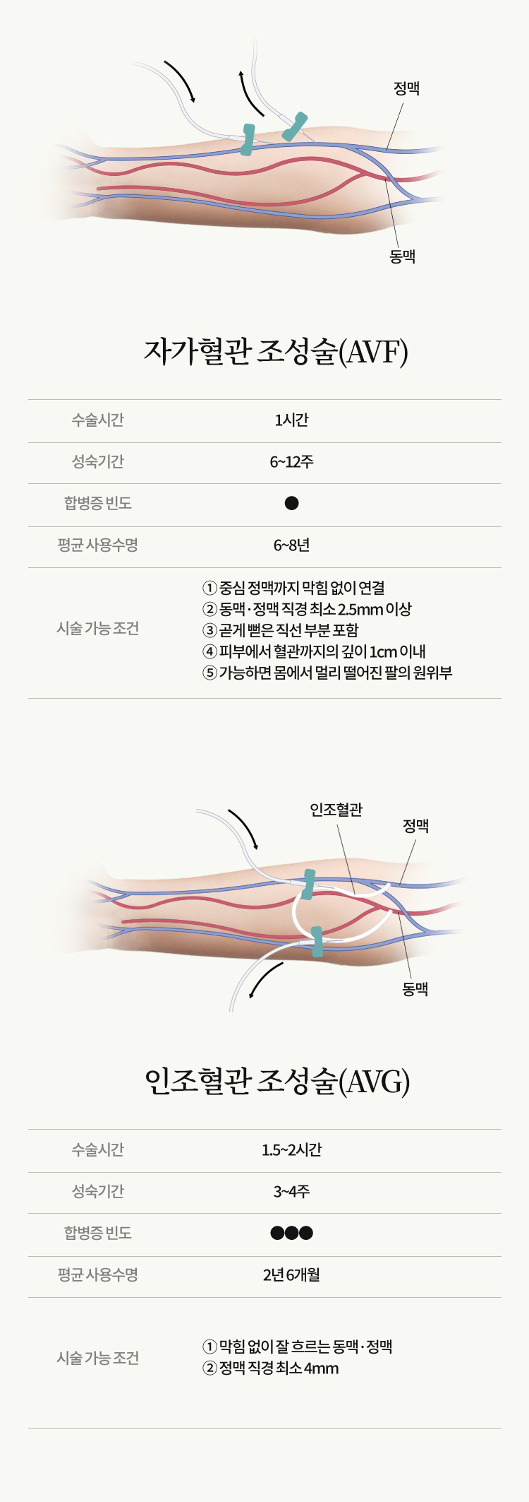 투석혈관의 조성