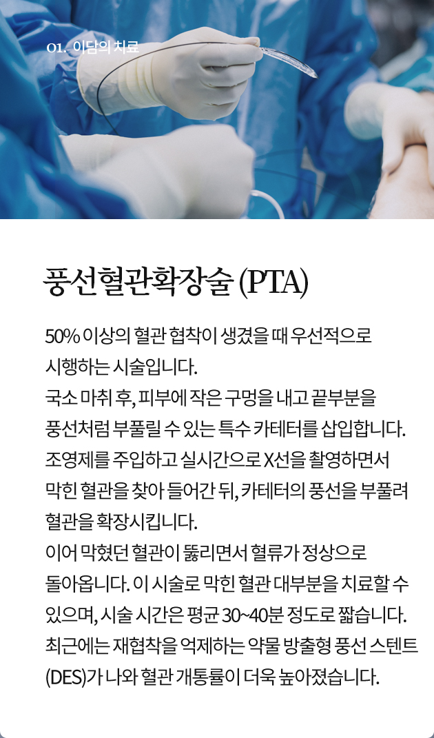 풍선혈관확장술 (PTA)