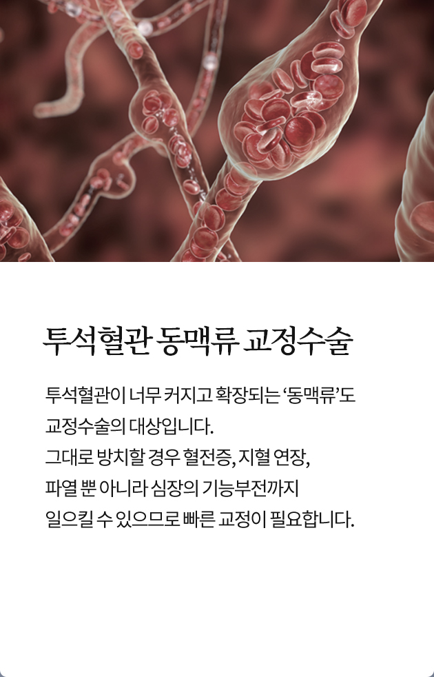 투석혈관 동맥류 교정수술