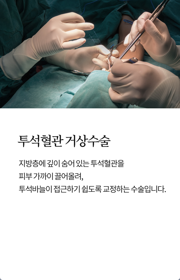 투석혈관 거상수술