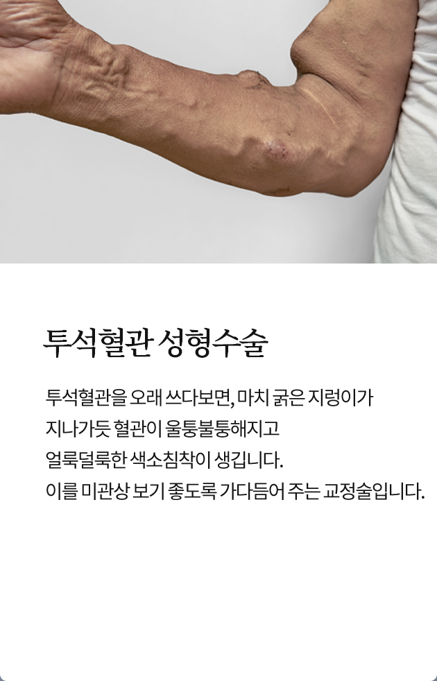 투석혈관 성형수술