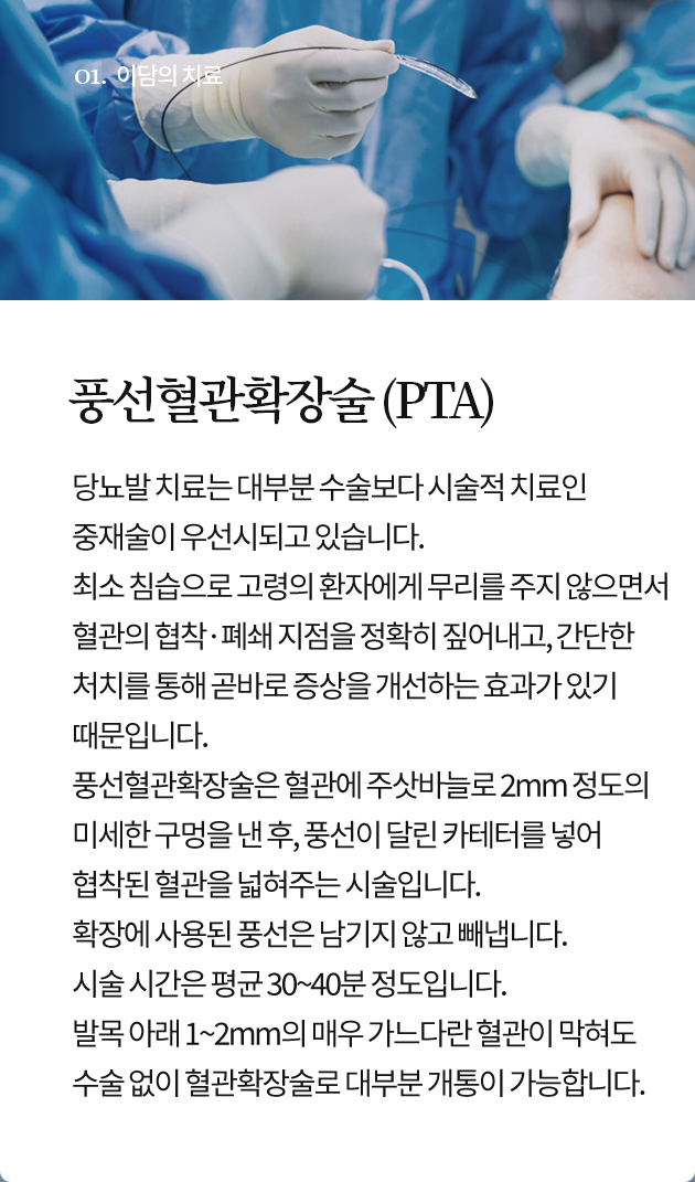 풍선혈관확장술 (PTA)