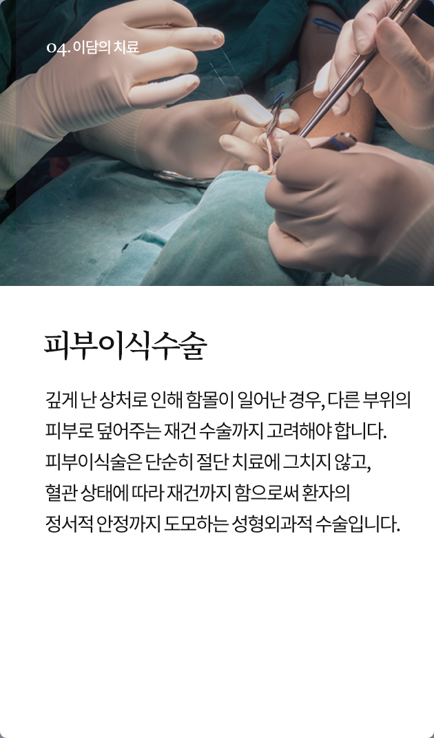 피부이식수술