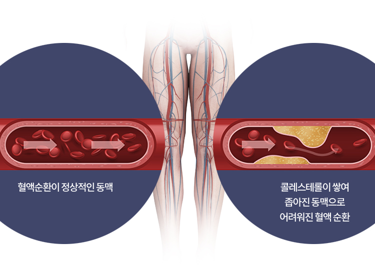 원인