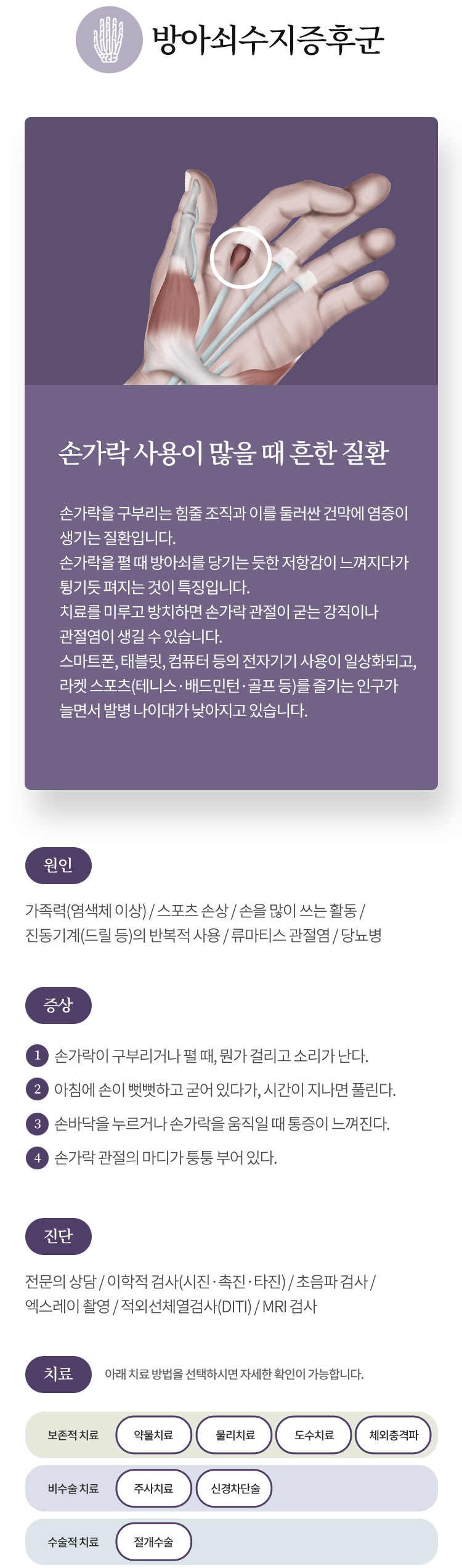 방아쇠수지증후군