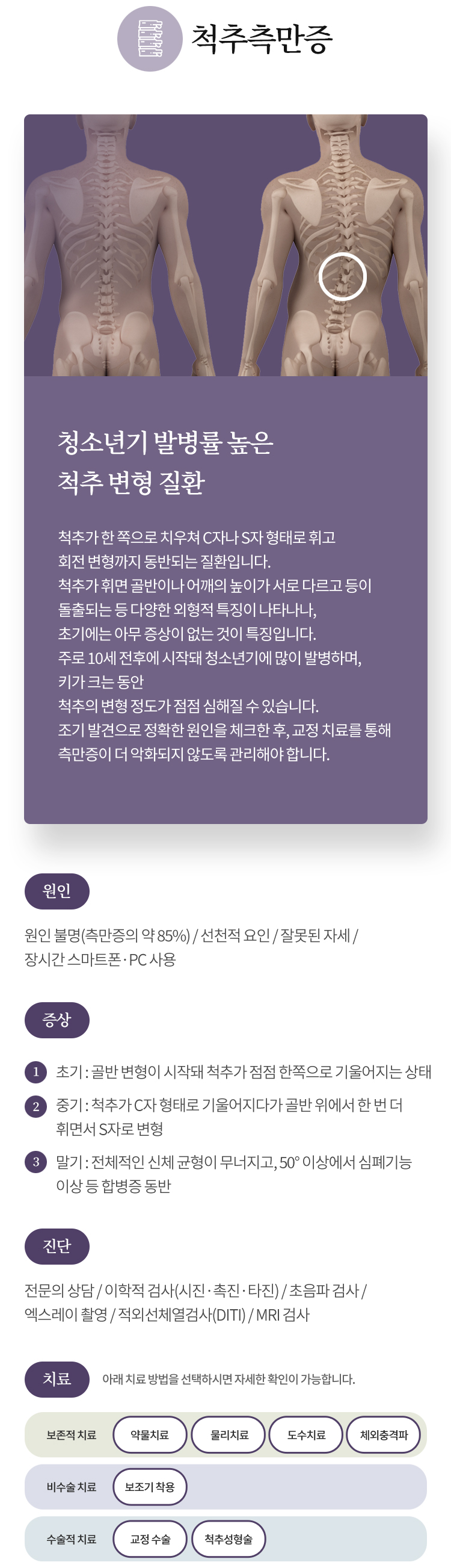 척추측만증