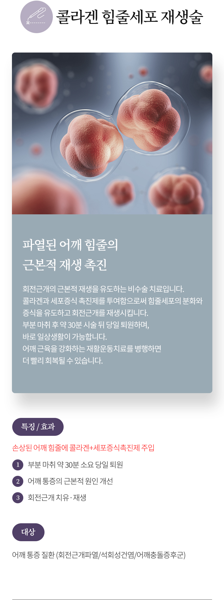 콜라겐 힘줄세포 재생술