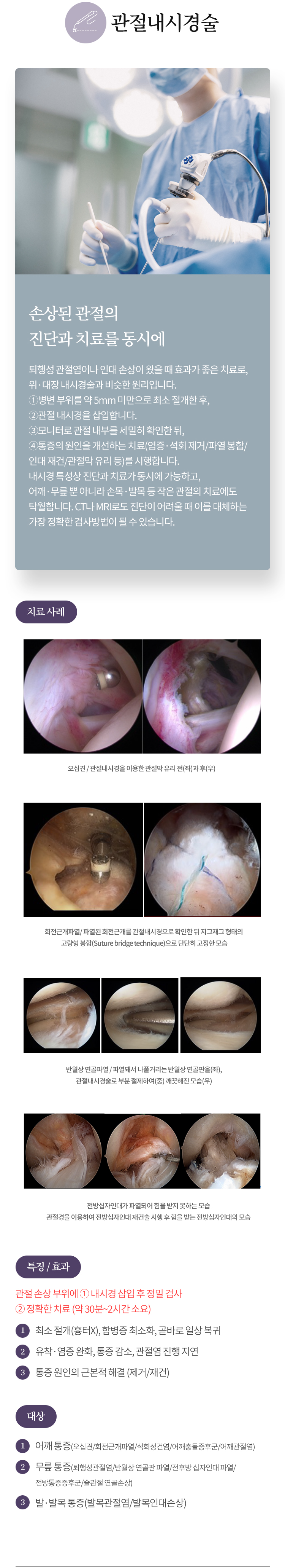 관절내시경술