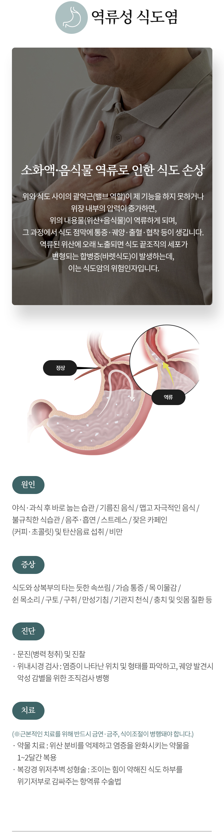 역류성 식도염