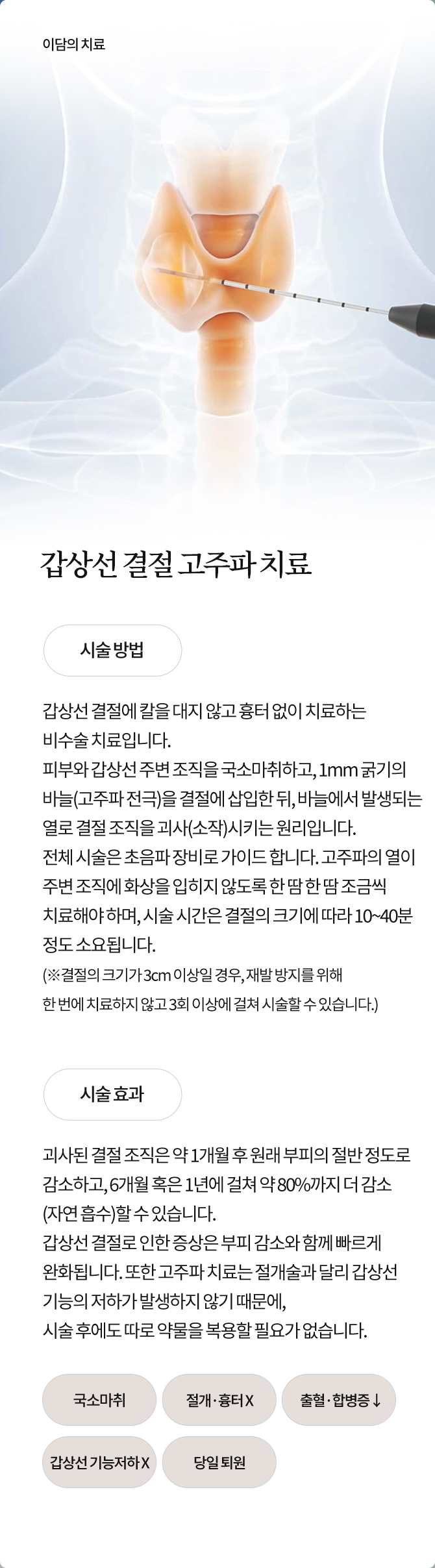 갑상선 결절 고주파 치료