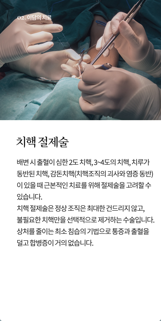 치핵 절제술